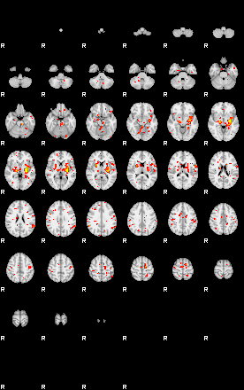 Patient:16;component:128