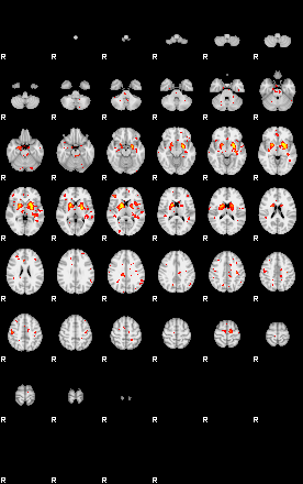 Patient:16;component:129