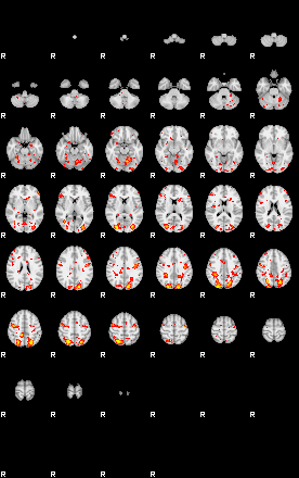 Patient:16;component:132