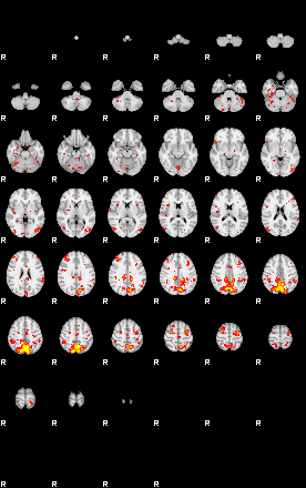 Patient:16;component:15