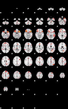 Patient:16;component:164