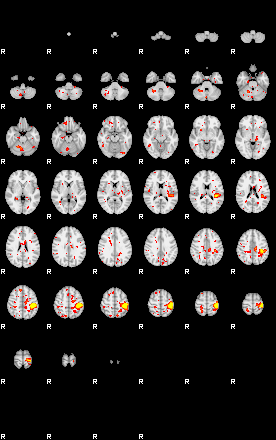 Patient:16;component:21