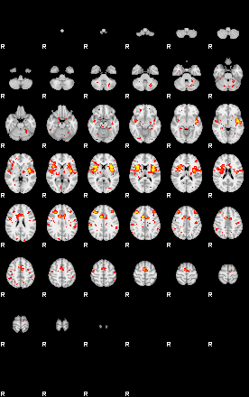 Patient:16;component:25