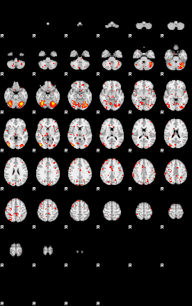 Patient:17;component:122