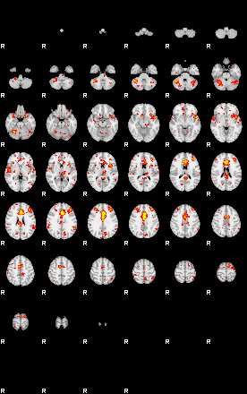 Patient:17;component:125