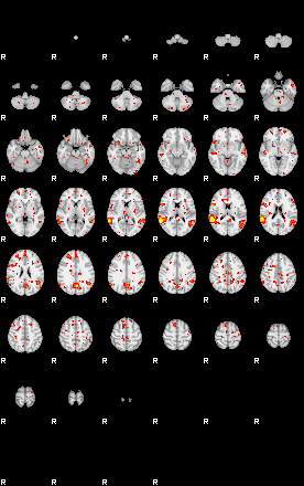 Patient:17;component:131