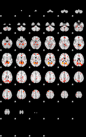 Patient:17;component:29