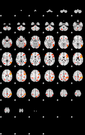 Patient:18;component:109