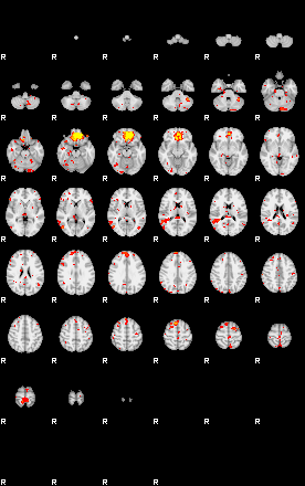 Patient:18;component:113