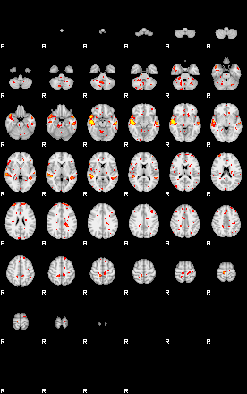 Patient:18;component:120