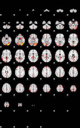 Patient:18;component:122