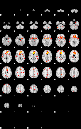 Patient:18;component:125