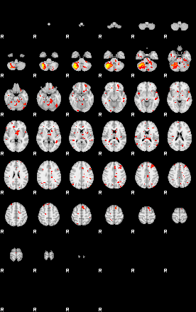 Patient:18;component:130