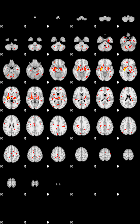 Patient:18;component:159