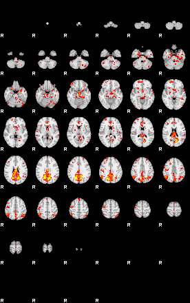 Patient:18;component:160