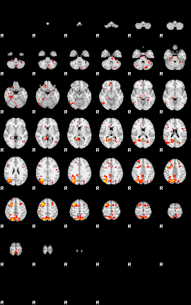 Patient:18;component:166