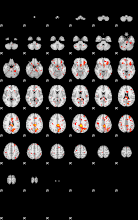 Patient:18;component:180