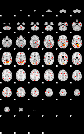 Patient:18;component:181