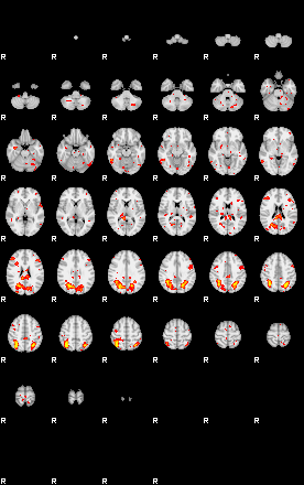 Patient:18;component:182