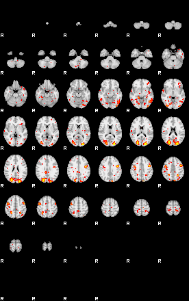 Patient:18;component:189