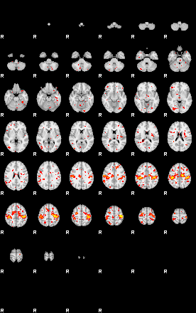 Patient:18;component:21