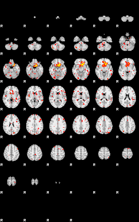 Patient:18;component:43