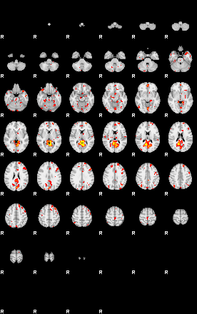 Patient:18;component:5