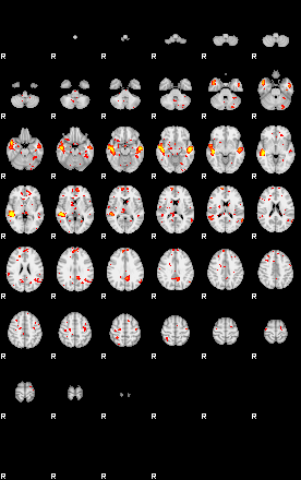 Patient:20;component:11