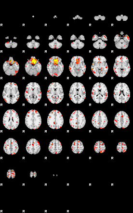 Patient:20;component:43