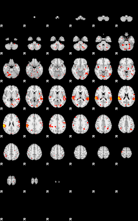 Patient:21;component:150