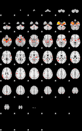 Patient:21;component:185