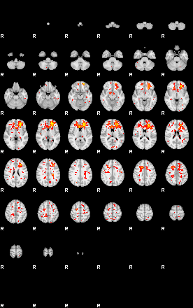 Patient:21;component:193