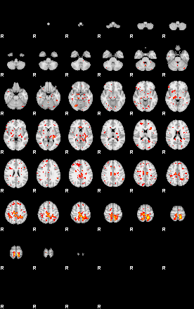 Patient:21;component:55