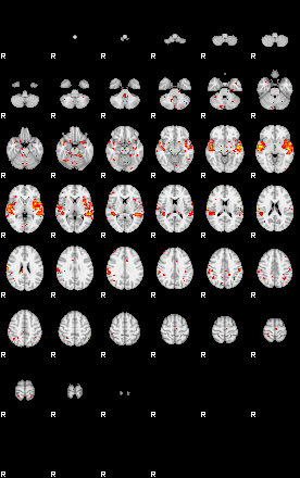 Patient:21;component:58