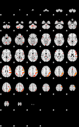 Patient:21;component:60