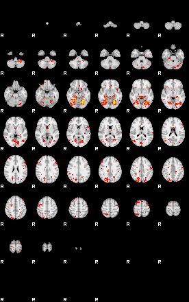 Patient:22;component:126