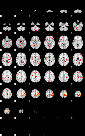 Patient:22;component:21