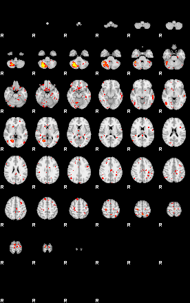 Patient:23;component:130