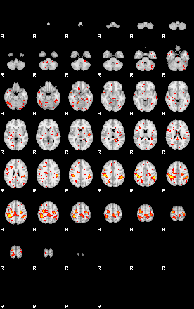 Patient:23;component:15