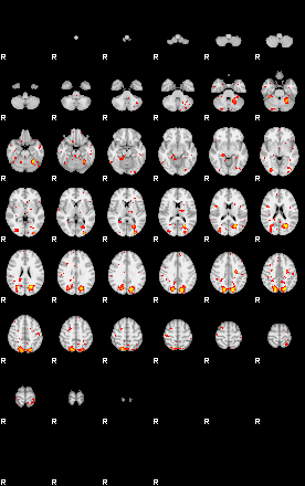 Patient:23;component:183