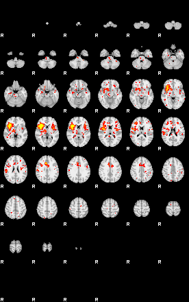 Patient:24;component:151