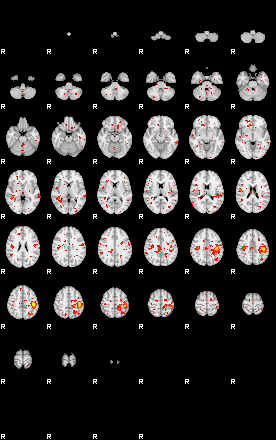 Patient:24;component:21