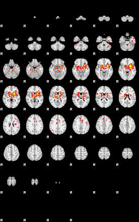 Patient:24;component:39