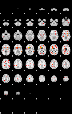 Patient:25;component:112