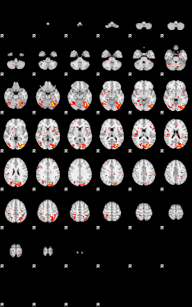 Patient:25;component:122