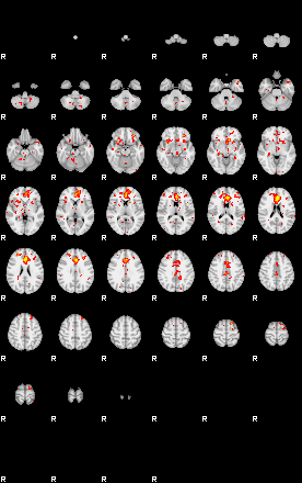 Patient:25;component:125