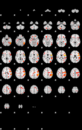 Patient:25;component:141