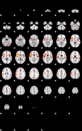 Patient:25;component:151