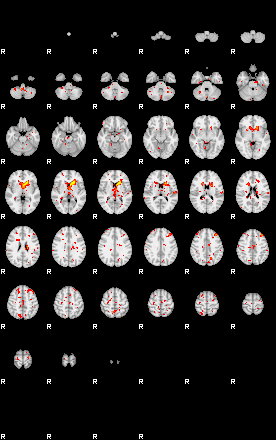 Patient:25;component:153