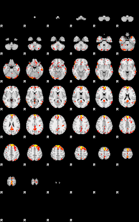 Patient:25;component:155